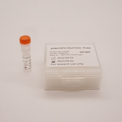 ATM/CSP11 Dual Color Probe For Detecting Abnormality Of Human ATM(11q22) Gene